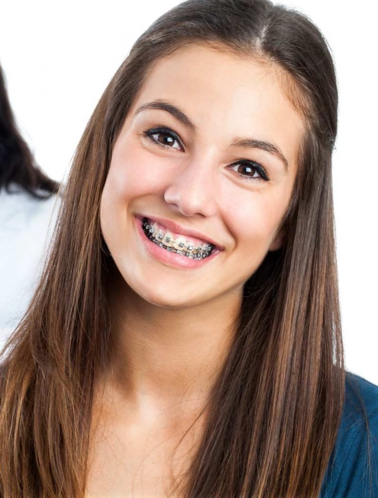 Braces for Adults Orthodontist Ottawa ON Centrepointe Orthodontics