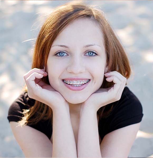 Retainers Retainers